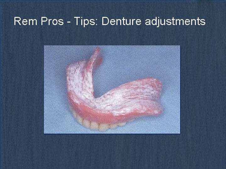 Rem Pros - Tips: Denture adjustments 