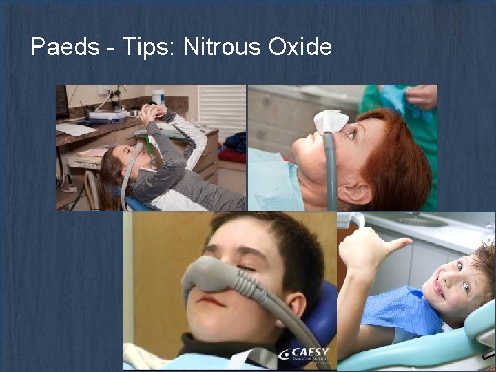 Paeds - Tips: Nitrous Oxide 