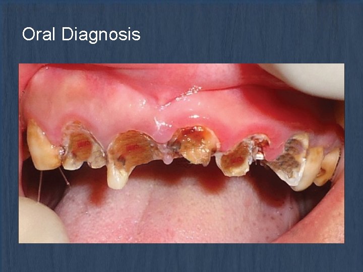 Oral Diagnosis 
