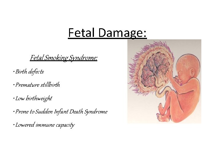 Fetal Damage: Fetal Smoking Syndrome: • Birth defects • Premature stillbirth • Low birthweight