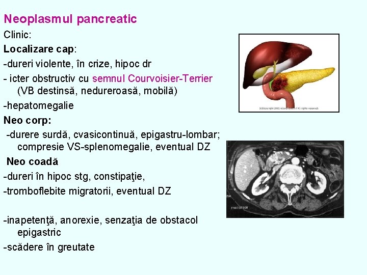 Neoplasmul pancreatic Clinic: Localizare cap: -dureri violente, în crize, hipoc dr - icter obstructiv