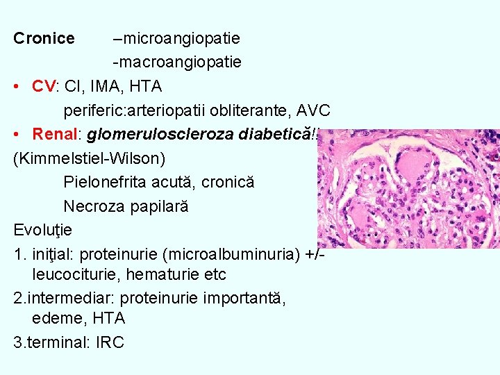 Cronice –microangiopatie -macroangiopatie • CV: CI, IMA, HTA periferic: arteriopatii obliterante, AVC • Renal: