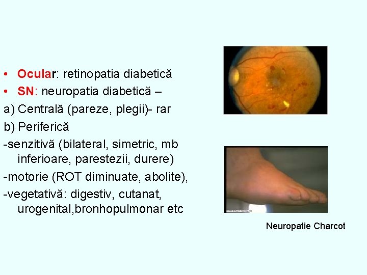  • Ocular: retinopatia diabetică • SN: neuropatia diabetică – a) Centrală (pareze, plegii)-