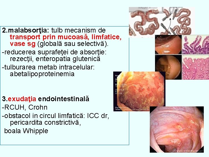 2. malabsorţia: tulb mecanism de transport prin mucoasă, limfatice, vase sg (globală sau selectivă).
