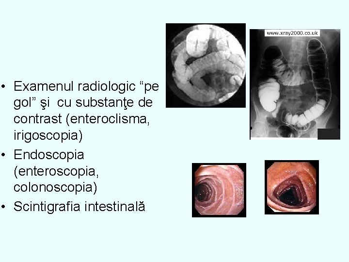  • Examenul radiologic “pe gol” şi cu substanţe de contrast (enteroclisma, irigoscopia) •