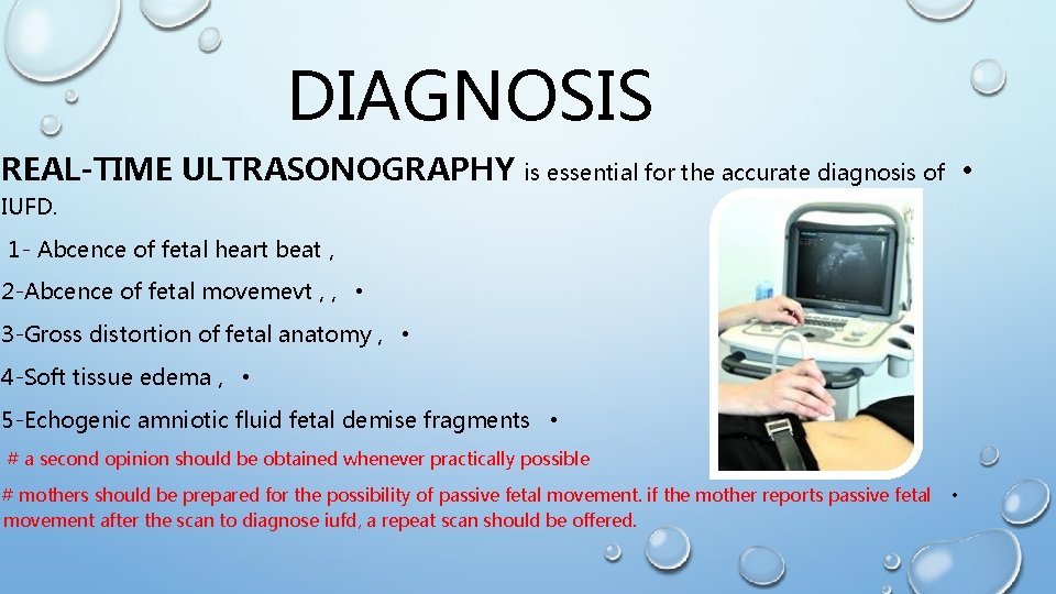 DIAGNOSIS REAL-TIME ULTRASONOGRAPHY • is essential for the accurate diagnosis of IUFD. 1 -