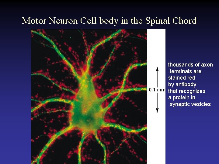 Motor Neuron Cell body in the Spinal Chord thousands of axon terminals are stained