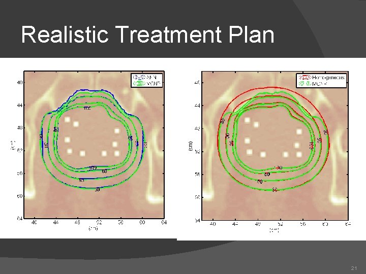 Realistic Treatment Plan 21 Realistic Treatment Plan 21