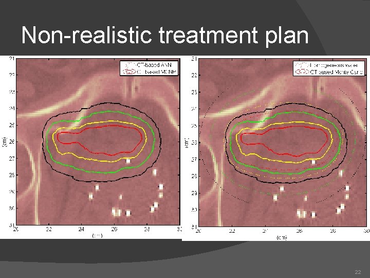 Non-realistic treatment plan 22 Non-realistic treatment plan 22