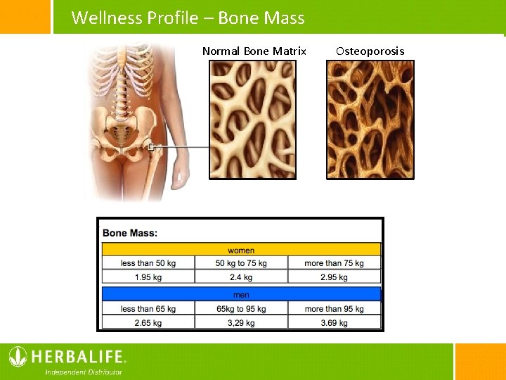 Wellness Profile – Bone Mass Normal Bone Matrix Osteoporosis 