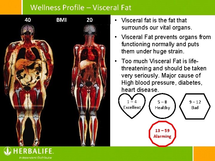 Wellness Profile – Visceral Fat 40 BMI 20 • Visceral fat is the fat