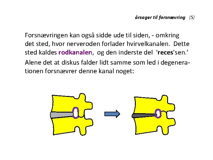 årsager til forsnævring (5) Forsnævringen kan også sidde ude til siden, - omkring det