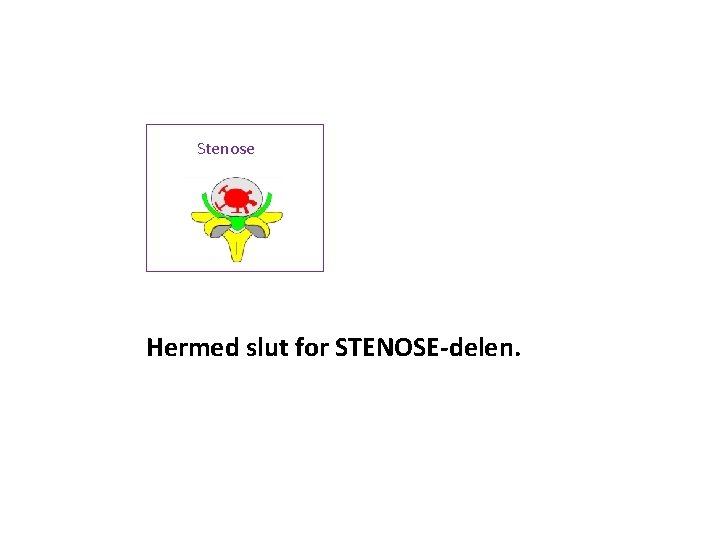 Stenose Hermed slut for STENOSE-delen. 