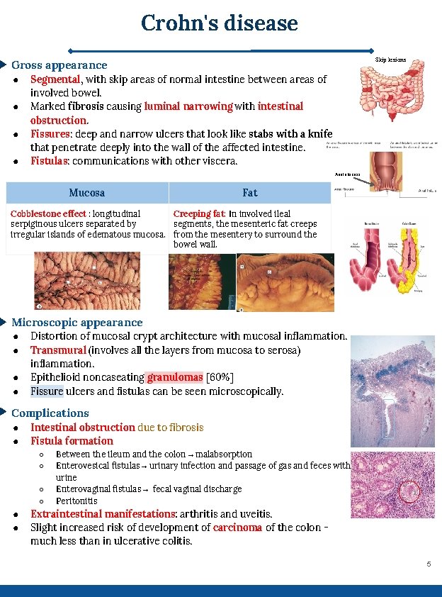 Crohn's disease Skip lesions Gross appearance ● ● Segmental, with skip areas of normal