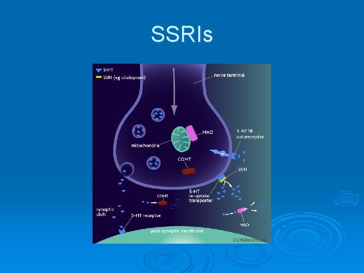 SSRIs 