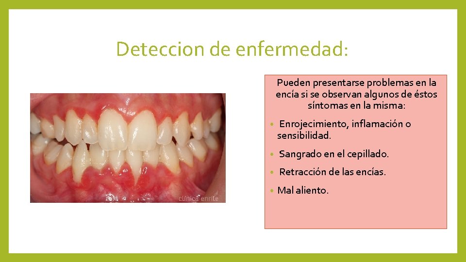 Deteccion de enfermedad: Pueden presentarse problemas en la encía si se observan algunos de