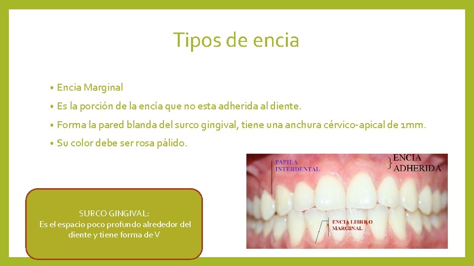 Tipos de encia • Encia Marginal • Es la porción de la encía que