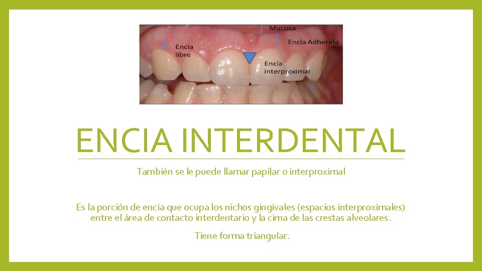 ENCIA INTERDENTAL También se le puede llamar papilar o interproximal Es la porción de