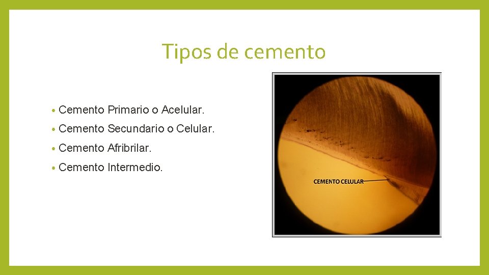 Tipos de cemento • Cemento Primario o Acelular. • Cemento Secundario o Celular. •