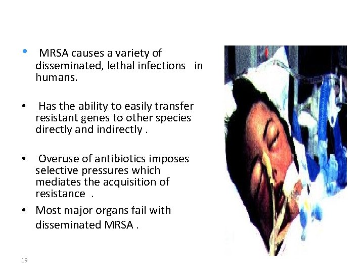  • MRSA causes a variety of disseminated, lethal infections in humans. • Has