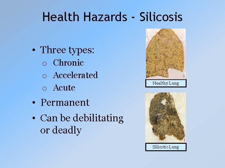 Health Hazards - Silicosis o Chronic o Accelerated o Acute CDC • Three types: