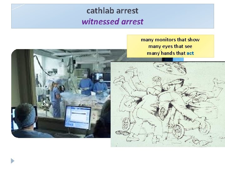 cathlab arrest witnessed arrest many monitors that show many eyes that see many hands