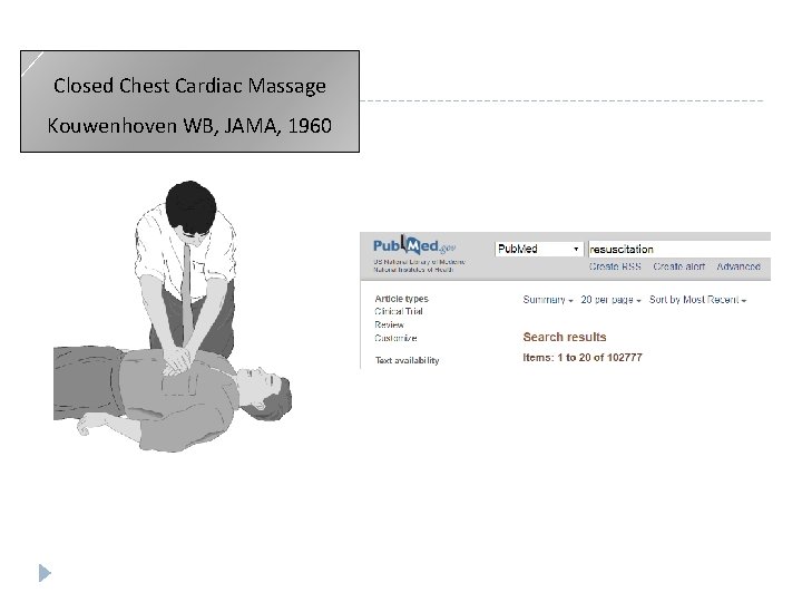 Closed Chest Cardiac Massage Κouwenhoven WB, JAMA, 1960 