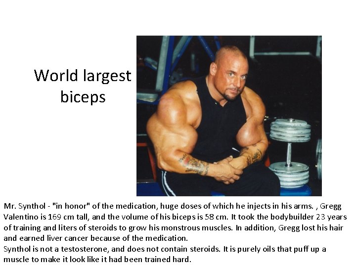 World largest biceps Mr. Synthol - "in honor" of the medication, huge doses of