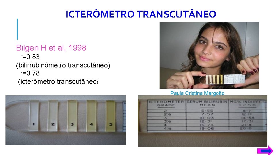 ICTERÔMETRO TRANSCUT NEO Bilgen H et al, 1998 r=0, 83 (bilirrubinômetro transcutâneo) r=0, 78