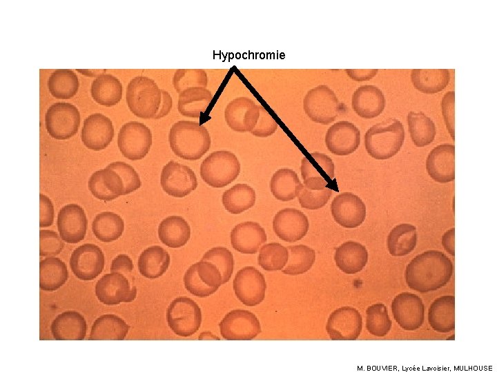 Hypochromie M. BOUVIER, Lycée Lavoisier, MULHOUSE 