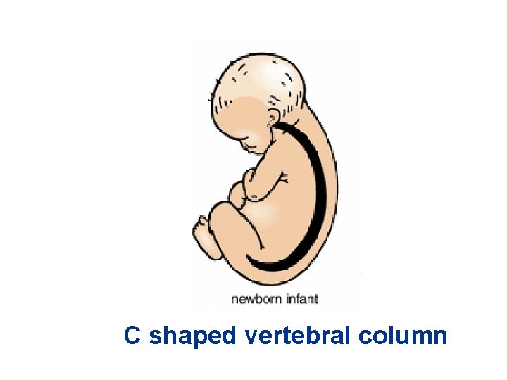 C shaped vertebral column 