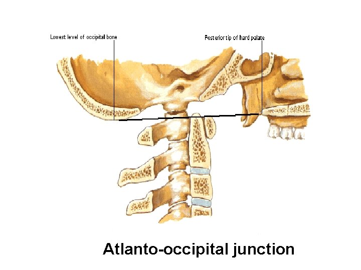 Atlanto-occipital junction 