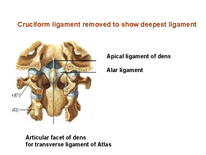 Cruciform ligament removed to show deepest ligament Apical ligament of dens Alar ligament Articular