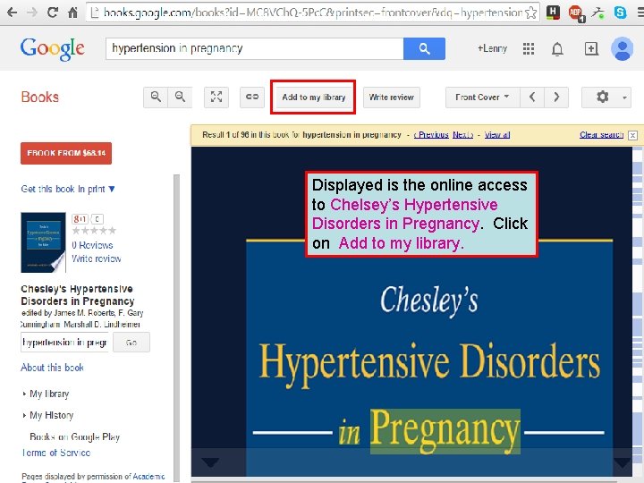 Displayed is the online access to Chelsey’s Hypertensive Disorders in Pregnancy. Click on Add