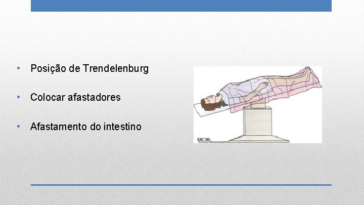  • Posição de Trendelenburg • Colocar afastadores • Afastamento do intestino 