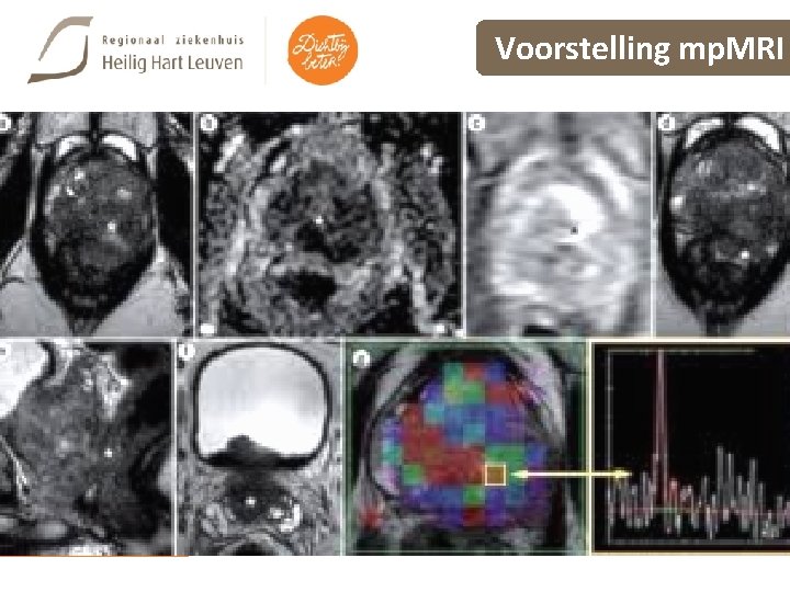 Voorstelling mp. MRI 