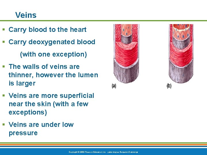 Veins § Carry blood to the heart § Carry deoxygenated blood (with one exception)