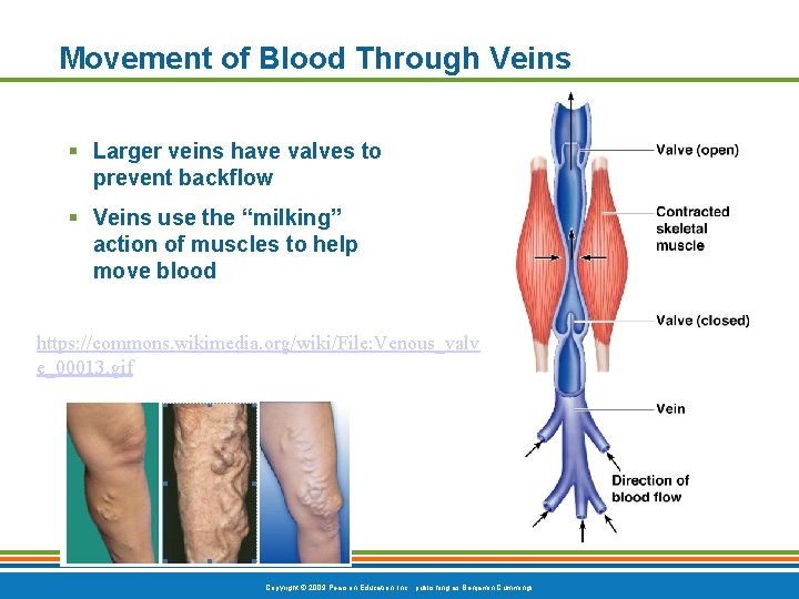 Movement of Blood Through Veins § Larger veins have valves to prevent backflow §