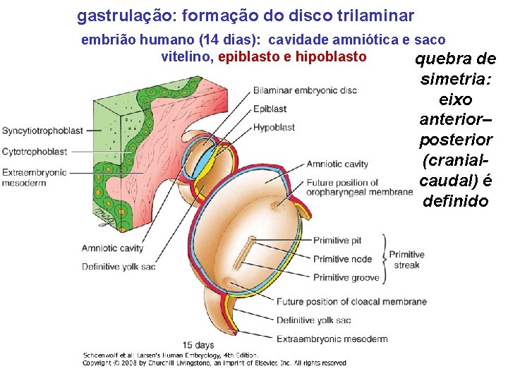 gastrulação: formação do disco trilaminar embrião humano (14 dias): cavidade amniótica e saco vitelino,