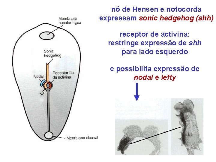 nó de Hensen e notocorda Genes que regulam a assimetria direita-esquerda expressam sonic hedgehog