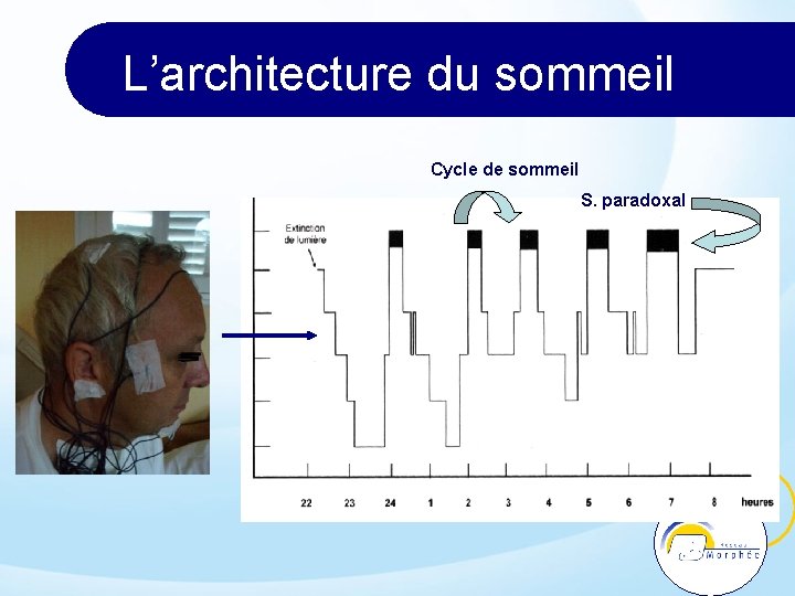 L’architecture du sommeil Cycle de sommeil S. paradoxal 