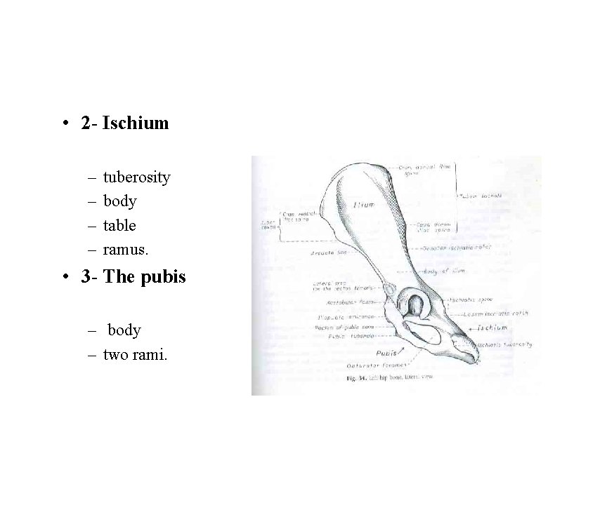  • 2 - Ischium – – tuberosity body table ramus. • 3 -