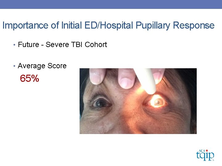 Importance of Initial ED/Hospital Pupillary Response • Future - Severe TBI Cohort • Average