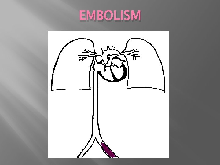 EMBOLISM 