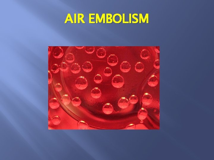 AIR EMBOLISM 