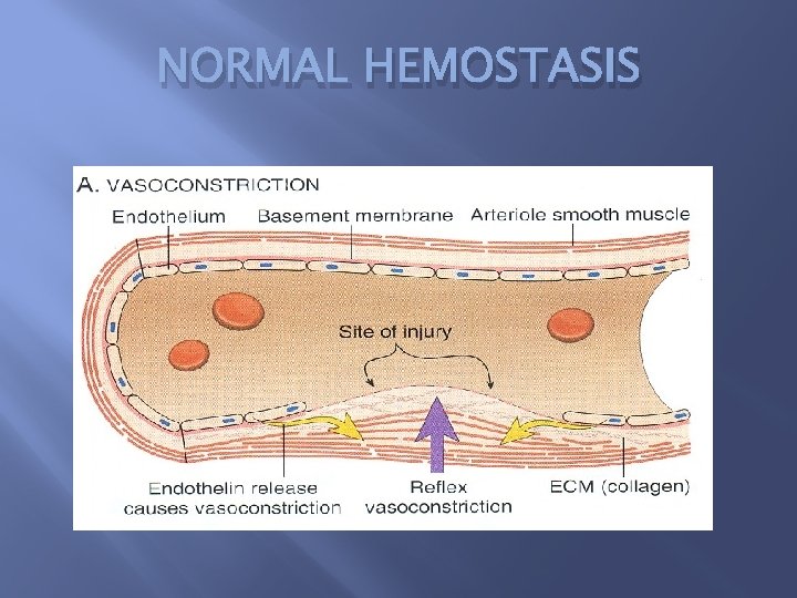 NORMAL HEMOSTASIS 
