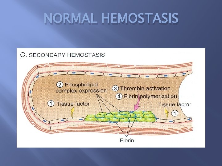 NORMAL HEMOSTASIS 