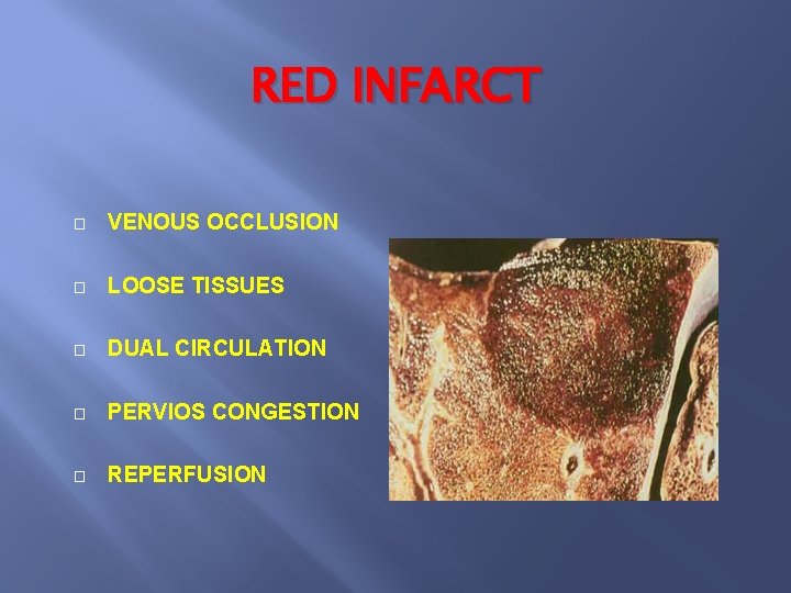 RED INFARCT � VENOUS OCCLUSION � LOOSE TISSUES � DUAL CIRCULATION � PERVIOS CONGESTION