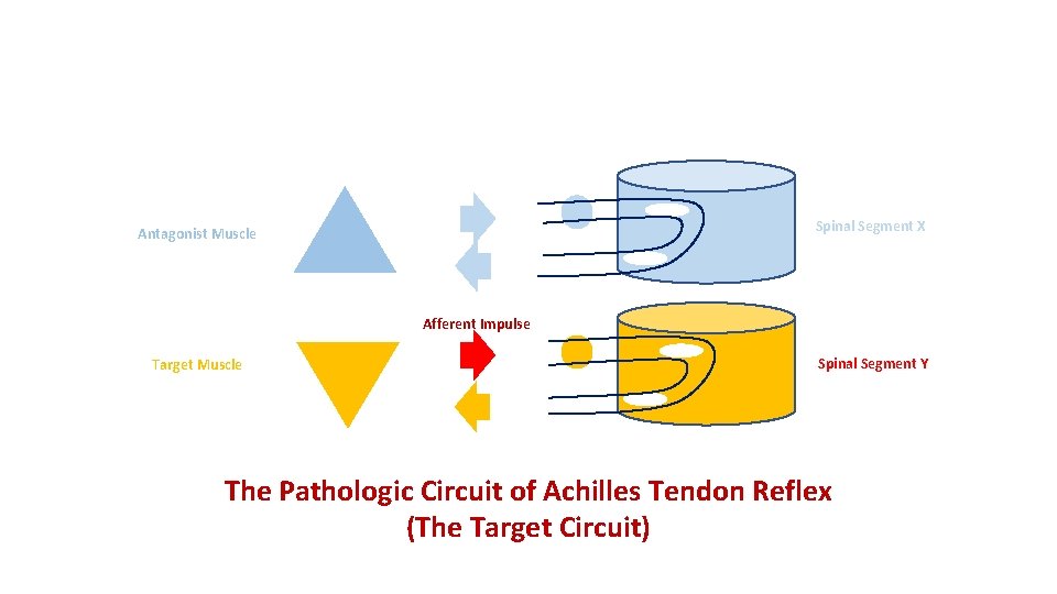 Spinal Segment X Antagonist Muscle Afferent Impulse Target Muscle Spinal Segment Y The Pathologic