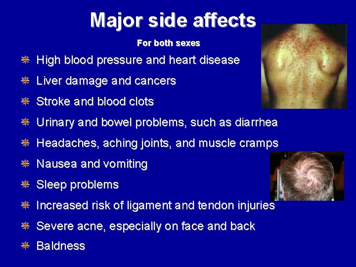 Major side affects For both sexes High blood pressure and heart disease Liver damage